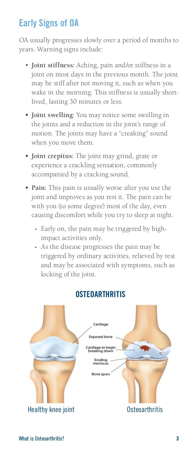 OsteoarthritisCausesSymptomsandTreatments