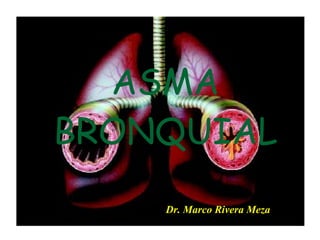 ASMA BRONQUIAL Dr. Marco Rivera Meza 
