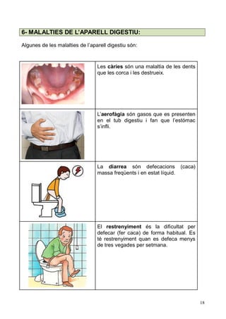 18 
6- MALALTIES DE L’APARELL DIGESTIU: 
Algunes de les malalties l’aparell digestiu són: 
Les càries són una malaltia de les dents que les corca i destrueix. 
L’aerofàgia són gasos que es presenten en el tub digestiu i fan que l’estómac s’infli. 
La diarrea són defecacions (caca) massa freqüents i en estat líquid. 
El restrenyiment és la dificultat per defecar (fer caca) de forma habitual. Es té restrenyiment quan es defeca menys de tres vegades per setmana. 
 