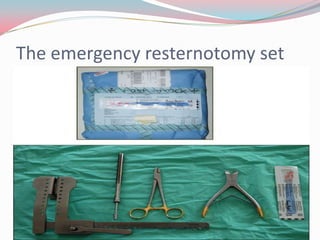 CAafter cardiac surgery | PPTX