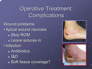 Operative Treatment:
Complications
Wound problems
• Apical wound necrosis
Stop ROM
Leave sutures in
• Infection
Antibiotics
I&D
Soft tissue coverage?

 