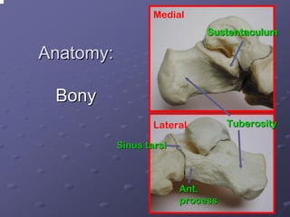 Medial
Sustentaculum

Anatomy:
Bony
Lateral
Sinus tarsi

Ant.
process

Tuberosity

 
