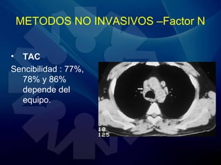 METODOS NO INVASIVOS –Factor N
• TAC
Sencibilidad : 77%,
78% y 86%
depende del
equipo.
 