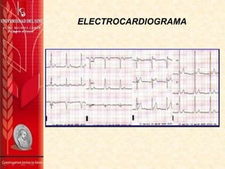 ELECTROCARDIOGRAMA

 