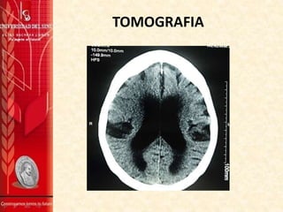 TOMOGRAFIA

 