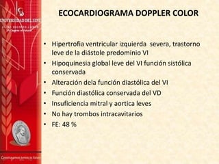 ECOCARDIOGRAMA DOPPLER COLOR
• Hipertrofia ventricular izquierda severa, trastorno
leve de la diástole predominio VI
• Hipoquinesia global leve del VI función sistólica
conservada
• Alteración dela función diastólica del VI
• Función diastólica conservada del VD
• Insuficiencia mitral y aortica leves
• No hay trombos intracavitarios
• FE: 48 %

 