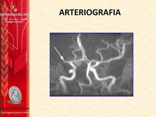 ARTERIOGRAFIA

 
