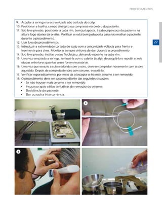 PROCEDIMENTOS

9.	 Acoplar a seringa na extremidade não cortada do scalp.
10.	 Posicionar a toalha, campo cirúrgico ou compressa no ombro do paciente.
11.	 Sob leve pressão, posicionar a cuba rim, bem justaposta, à cabeça/pescoço do paciente na
altura logo abaixo da orelha. Verificar se está bem justaposta para não molhar o paciente
durante o procedimento.
12.	 Usar luva de procedimentos.
13.	 Introduzir a extremidade cortada do scalp com a concavidade voltada para frente e
levemente para cima. Monitorar sempre sintoma de dor durante o procedimento.
14.	 Sob leve pressão, instilar o soro fisiológico, deixando escoá-lo na cuba rim.
15.	 Uma vez esvaziada a seringa, removê-la com o cateter (scalp), desacoplá-la e repetir as seis
etapas anteriores quantas vezes forem necessárias.
16.	 Uma vez que esvazie a cuba redonda com o soro, deve-se completar novamente com o soro
aquecido. Depois de completa de soro com cerume, esvaziá-la.
17.	 Verificar esporadicamente por meio da otoscopia se há mais cerume a ser removido.
18.	 O procedimento deve ser suspenso diante das seguintes situações:
•	 Se não houver mais cerume a ser removido;
•	 Insucesso após várias tentativas de remoção do cerume;
•	 Desistência do paciente;
•	 Dor ou outra intercorrência.

27

 
