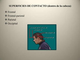 SUPERFICIES DE CONTACTO (dentro de la cabeza)
 Frontal
 Frontal-parietal
 Parietal
 Occipital

 