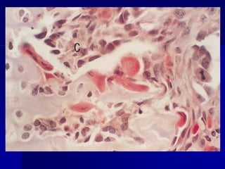 Cabeza, cuello huesos