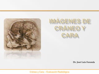 Cráneo y Cara – Evaluación Radiológica
Dr. José Luis Foronda
 