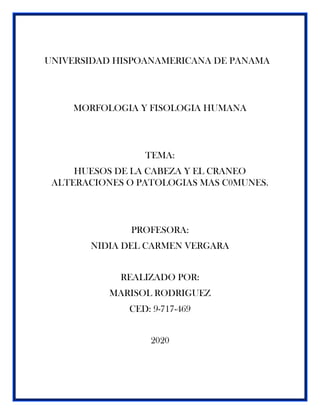 UNIVERSIDAD HISPOANAMERICANA DE PANAMA
MORFOLOGIA Y FISOLOGIA HUMANA
TEMA:
HUESOS DE LA CABEZA Y EL CRANEO
ALTERACIONES O PATOLOGIAS MAS C0MUNES.
PROFESORA:
NIDIA DEL CARMEN VERGARA
REALIZADO POR:
MARISOL RODRIGUEZ
CED: 9-717-469
2020
 