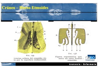 Cráneo – Hueso Etmoides
 