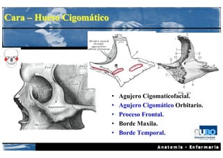 Cara – Hueso Cigomático




                          •   Agujero Cigomaticofacial.
                          •   Agujero Cigomático Orbitario.
                          •   Proceso Frontal.
                          •   Borde Maxila.
                          •   Borde Temporal.
 