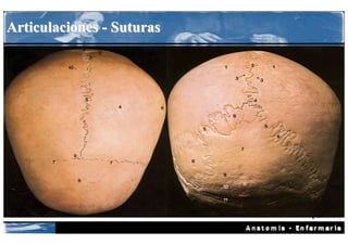 Articulaciones - Suturas
 