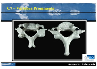C7 – Vértebra Prominente
 