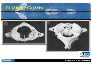 C1 (Atlas) – C2 (Axis)
 