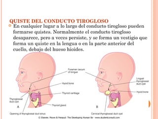 QUISTE DEL CONDUCTO TIROGLOSO
 En cualquier lugar a lo largo del conducto tirogloso pueden
formarse quistes. Normalmente el conducto tirogloso
desaparece, pero a veces persiste, y se forma un vestigio que
forma un quiste en la lengua o en la parte anterior del
cuello, debajo del hueso hioides.
 
