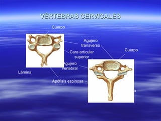 VÉRTEBRAS CERVICALESVÉRTEBRAS CERVICALES
Lámina
Apófisis espinosa
Agujero
vertebral
Cara articular
superior
Agujero
transverso
Lámina
Cuerpo
Cuerpo
 