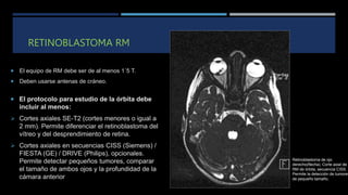 Rm Retinal CABEZA Y CUELLO PEDIA FINAL Tumores en pediatria | PPTX
