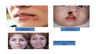 Cabeza y cuero cabelludo semiologia | PPTX
