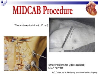 Coronary Artery Bypass Graft (CABG) - Desun Hospital Health Insight | PPT