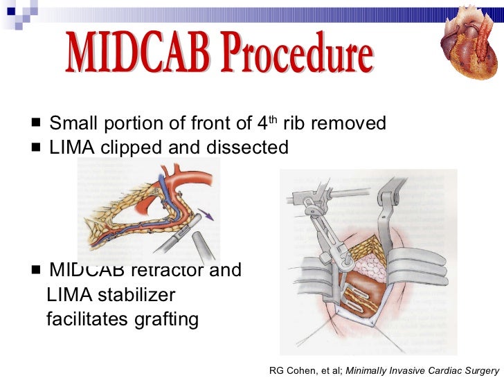 Coronary Artery Bypass Graft (CABG) Desun Hospital Health Insight