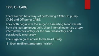 CABG | PPTX