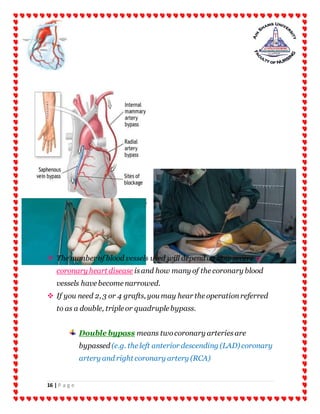 16 | P a g e
 The number of blood vessels used will depend on how severe a
coronary heart disease isand how many of the coronary blood
vessels have become narrowed.
 If you need 2, 3 or 4 grafts, you may hear the operationreferred
to as a double, triple or quadruple bypass.
Double bypass means twocoronary arteriesare
bypassed (e.g. the left anterior descending (LAD) coronary
artery and right coronary artery (RCA)
 