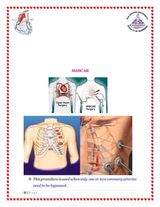 22 | P a g e
MIDCAB
 Thisprocedure isused when only one or two coronary arteries
need to be bypassed.
 