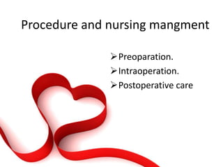 Cabg ppt | PPTX