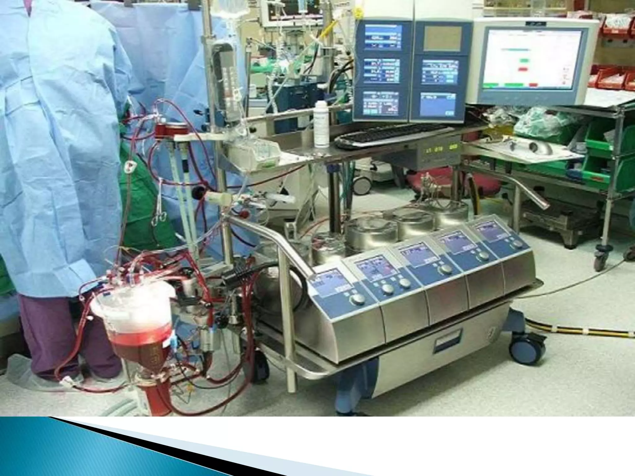 CABG | PPTX