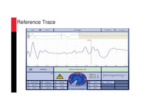 Reference Trace
 