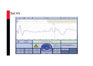 Set HV
 