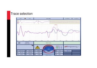 Trace selection
 
