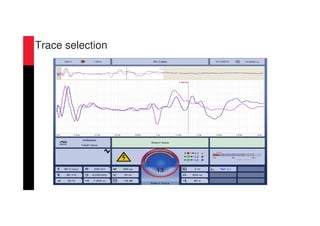 Trace selection
 