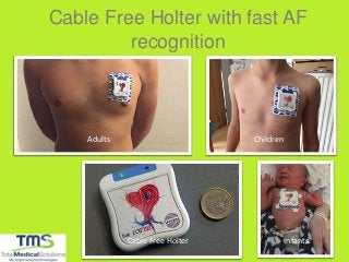 Cable Free Holter with fast AF
recognition
Adults Children
InfantsCable Free Holter
 