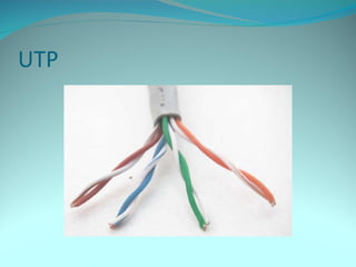 UTP
 