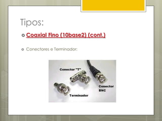 Tipos:Coaxial Fino (10base2)Este tipo de cabo coaxial é o mais utilizado. É chamado “fino” porque a seu diâmetro do cabo é menor que o cabo coaxial grosso.“10” significa taxa de transferência de 10 Mbps e “2” a extensão máxima de cada segmento de rede.Fig.1- Cabo Coaxial 10base2 