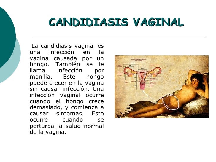 Las cremas del ungüento del hongo inguinal