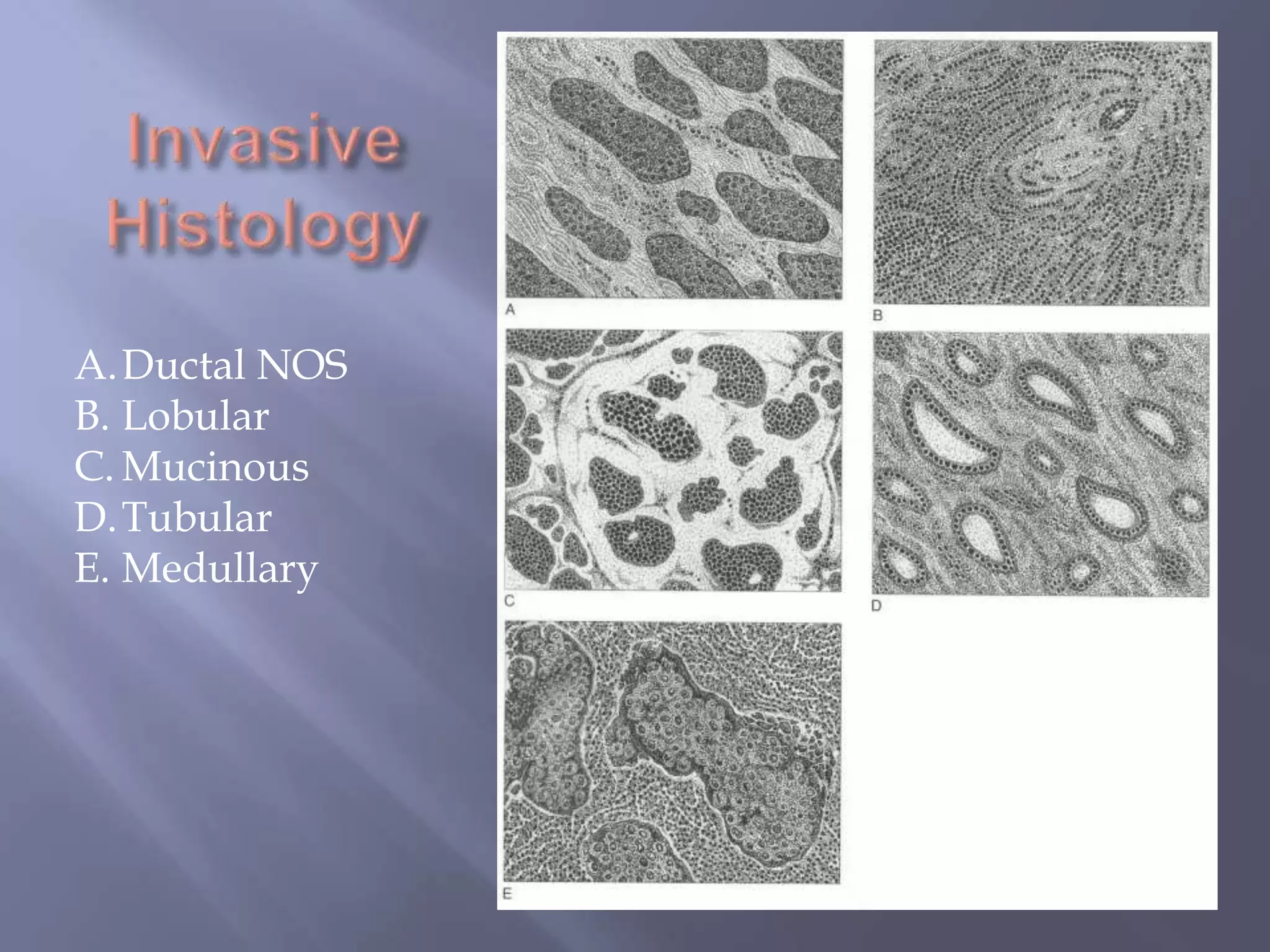 Invasive HistologyDuctal NOSLobularMucinousTubularMedullary