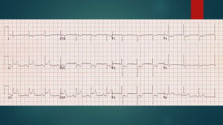 Circulation
End-points
Early goal-directed
therapy
Fluid choices
Vasopressor choices
three
 