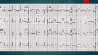 Circulation
End-points:
CVP
MAP
UO
three
Lactate
ScvO2
 