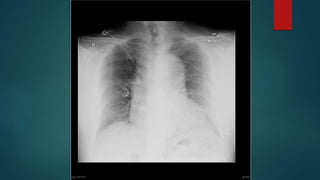 Circulation
Early goal-directed therapy
2001: 30.5% vs 46.5% mortality
2014: No difference, lower mortalities
(~20-29%)
Early Goal-directed Therapy in the Treatment of Severe Sepsis and Septic Shock. N
Engl J Med. 2001 Nov;345(19):1368-77
A Randomised Trial of Protocol-based Care for Early Septic Shock. N Engl J Med.
2014 May;370(18):1683-93
Goal-directed Resuscitation for Patients with Early Septic Shock. N Engl J Med. 2014
Oct;371:1496-1506
Trial of Early, Goal-Directed Resuscitation for Septic Shock. N Engl J Med. 2014
Apr;372:1301-1311
three
 
