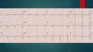 Supportive
Head-up
Sedation and analgesia
DVT prophylaxis
Stress ulcer prophylaxis
Nutrition
Care goals
six
 