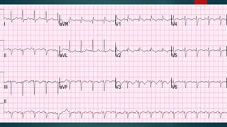 Summary
We are getting better
Recognise early
Give fluid but not too much
2014 trilogy of sepsis trials
Remember the 20% rule-of-thumb when talking to patient and families
Carry a six-pack with you
 