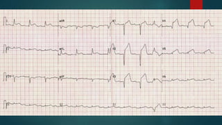Text
Sepsis Six Pack
 