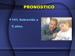 PRONOSTICOPRONOSTICO
14% Sobrevida a
5 años.
 