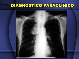 DIAGNOSTICO PARACLINICODIAGNOSTICO PARACLINICO
 