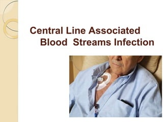 Central Line Associated
Blood Streams Infection
 
